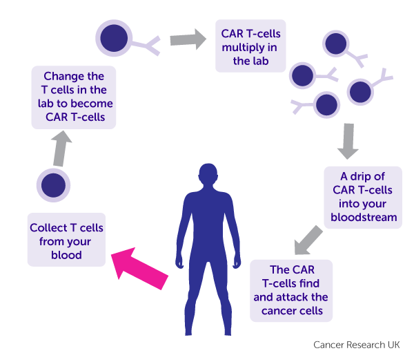 Khỏi hoàn toàn ung thư vú giai đoạn cuối nhờ liệu pháp Tế bào T (T-cell immunotherapy)
